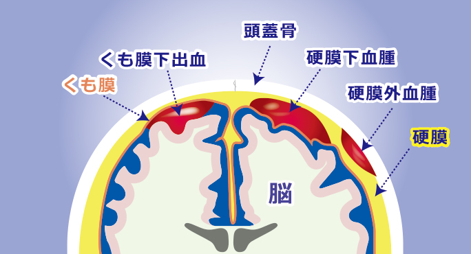頭部外傷 対応疾患 流山中央病院 脳神経外科ホームページです 日本脳神経血管内治療学会研修施設 認定病院 脳動脈瘤 クモ膜下出血 脳出血 脳梗塞などの血管障害だけでなく 脳動静脈奇形や硬膜動静脈瘻といった 珍しい疾患もカバーしています